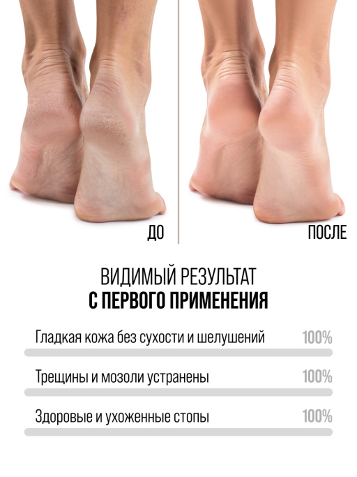 Крем для ног с мочевиной от трещин и натоптышей увлажняющий
