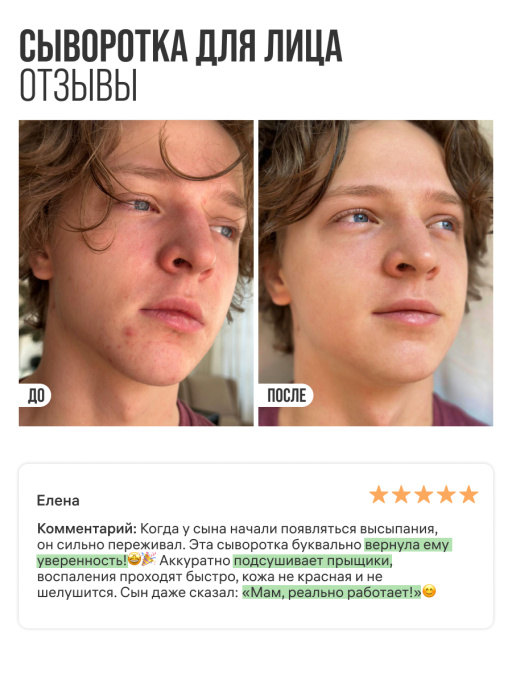 Сыворотка 7DAYS для лица от прыщей с Ниацинамидом и Цинком, набор 3 шт х 20 мл