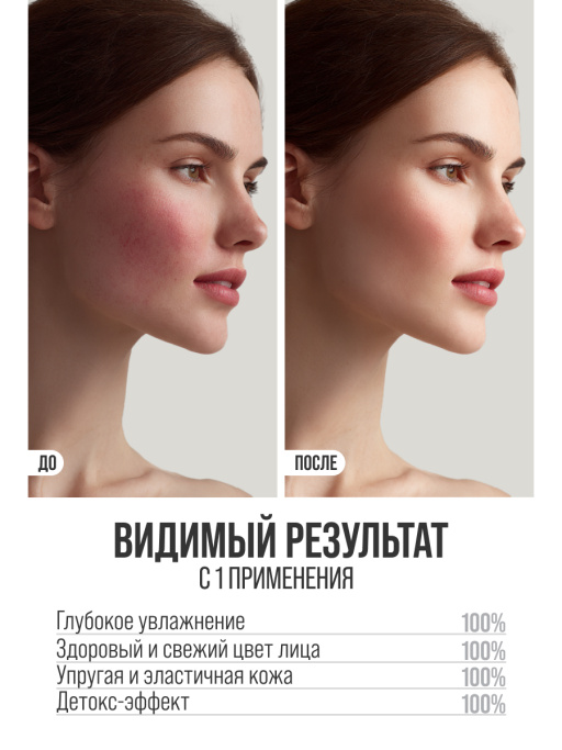 Сыворотка для лица увлажняющая MILKY BOOST SQUALANE 1,5%