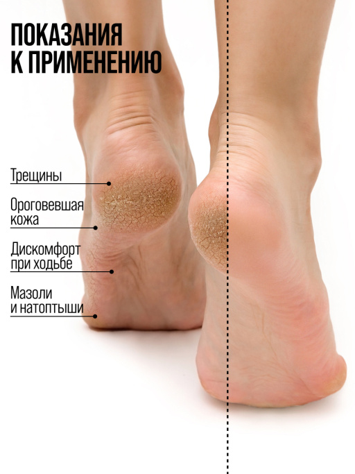 Крем для ног с мочевиной от трещин и натоптышей увлажняющий
